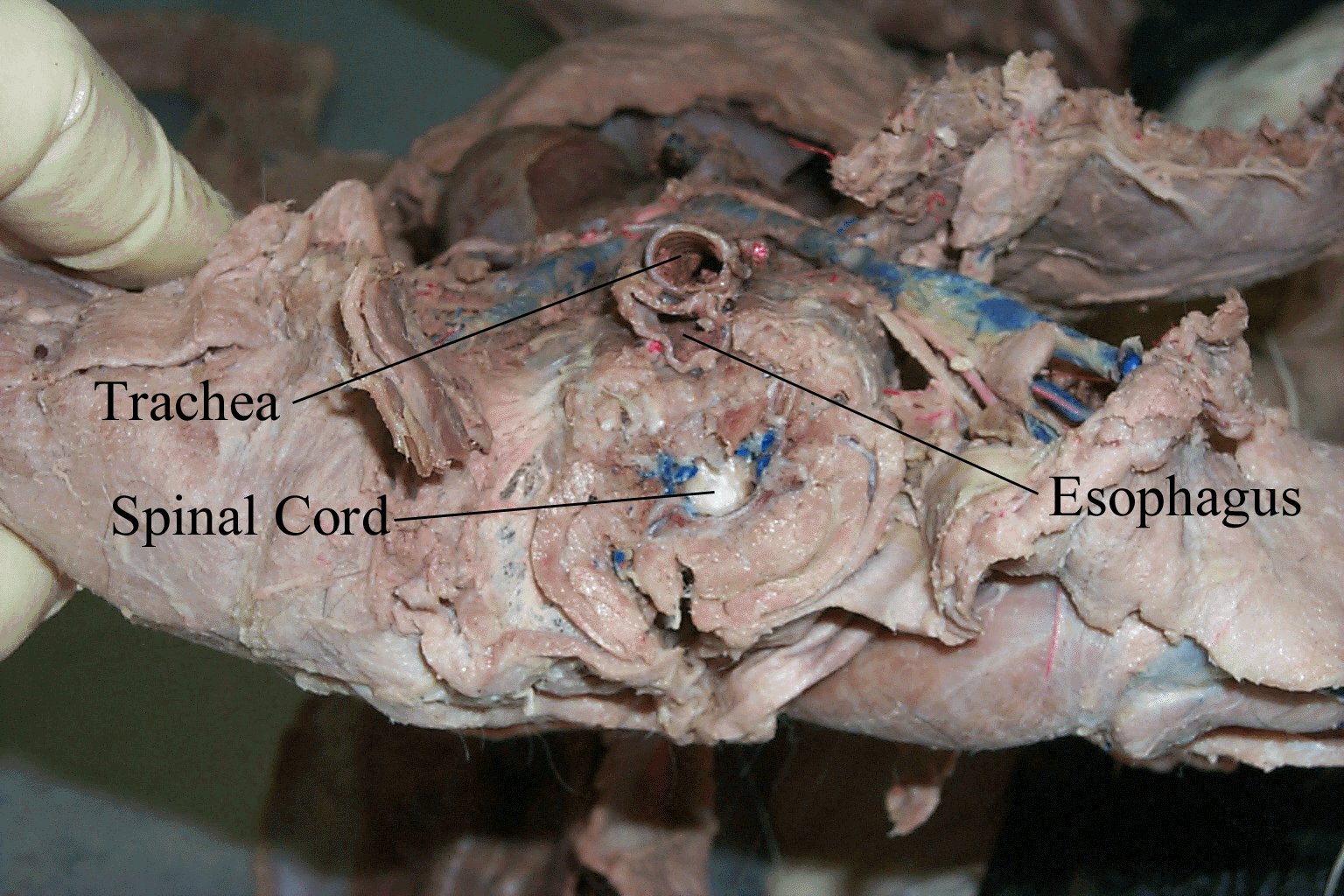 Trachea Anatomy Function Trachea And Esophagus Location